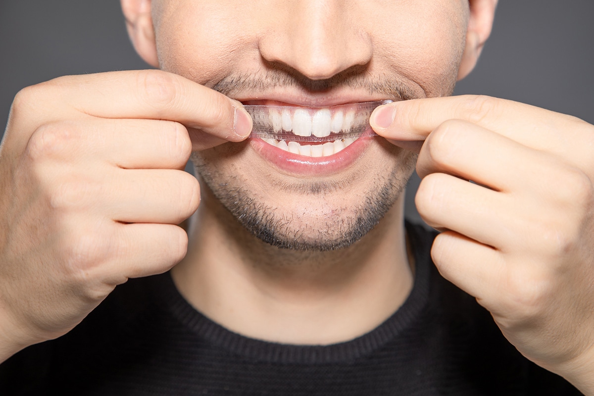Are teeth whitening treatments safe for sensitive teeth blog